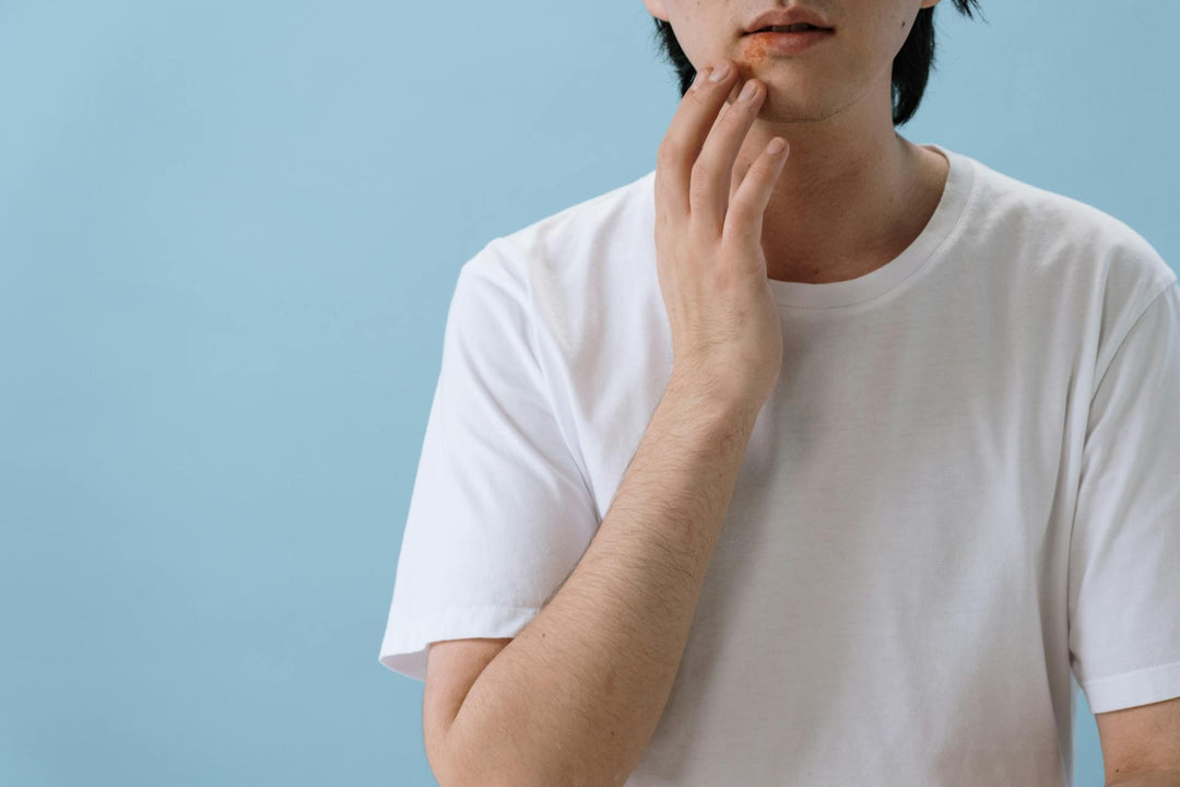 How to Treat Mouth Sores - SPC Medical Supplies